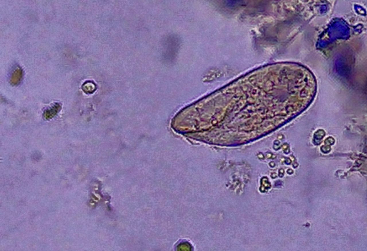 Il paramecio, il gigante dei Ciliati